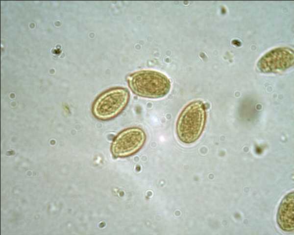 Corticium meridioroseum ?